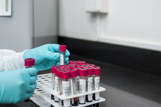 Key Factors to Consider — Biotech File Retention