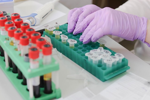 What the Data Doesn't Tell You — Lab Sample Rejections