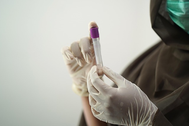 What 78 Labs at 0.9% Median Tell You About Your 62% — Lab Sample Rejections