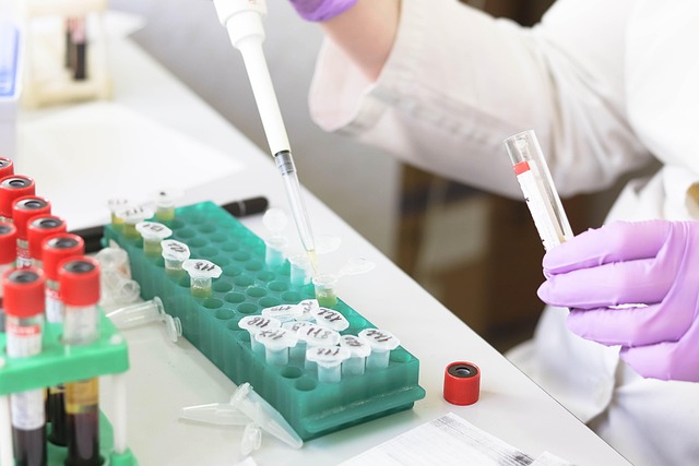 Quality Lead vs ,000 Consultant vs Nurse Champion — Lab Sample Rejections