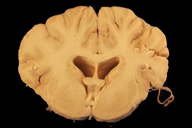 What 38ms Doesn't Tell You — Why 38ms RTT Matters for AI